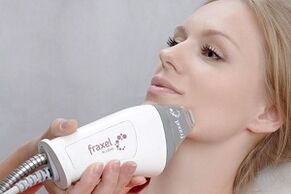 جوهر إجراء تجديد شباب بشرة الوجه الجزئي